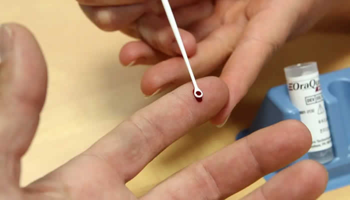 Recomiendan no vacunar a menores contra la Hepatitis B